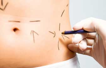 Cirurgia Plástica Mauá – Dr. Daniel Fleissig - Foto 1