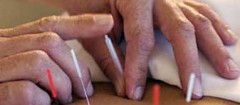 acupuntura-maua-1462306542